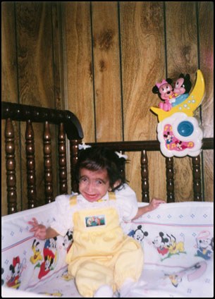 Lizzie Velasquez ตอนเด็ก