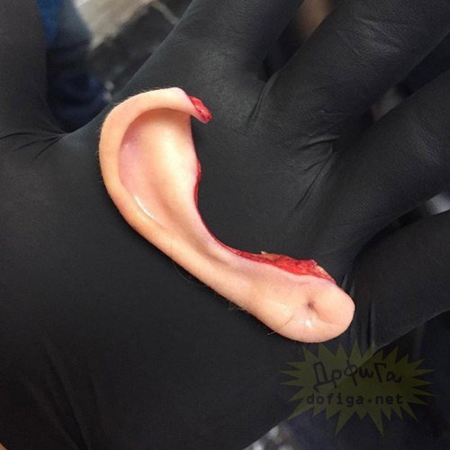 Åñëè ðàíüøå â óøàõ äåëàëè äûðêè è òóííåëè, òî ñåé÷àñ ïðîñòî íàïðîñòî îòðåçàþò ëèøíåå