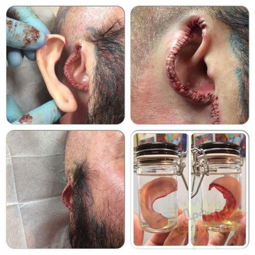 Ñóäÿ ïî ýòèì ôîòîãðàôèÿì, öåëîñòíîñòü óøíûõ ðàêîâèí íåêîòîðûå îñîáè ÷åëîâåêîâ ñòàâÿò íèæå ëè÷íûõ ïîíèìàíèé î ãàðìîíèè ñâîåãî îáëèêà..