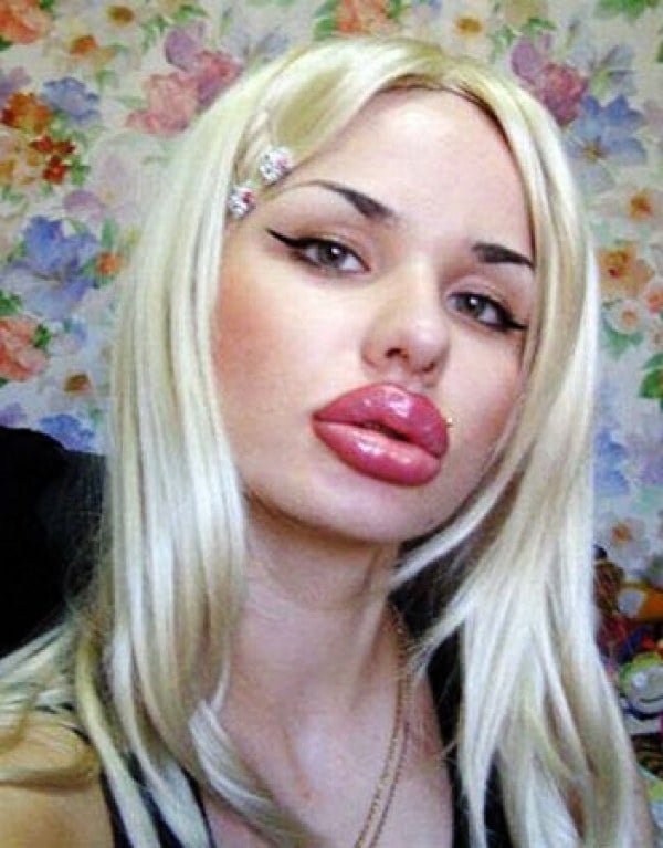 Kristina Rei over did her lips.