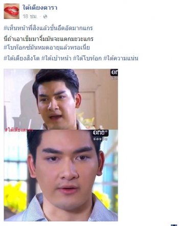 บวมหนักมาก !! ชาวเน็ตจวกเละ