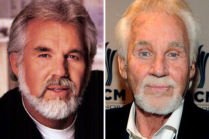kenny Rogers